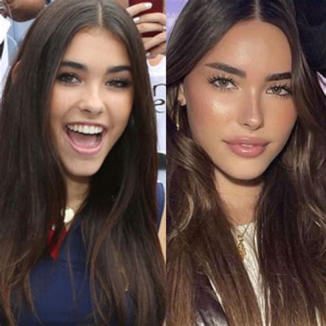 madison beer before plastic|Madison Beer Denies Plastic Surgery Rumors After。